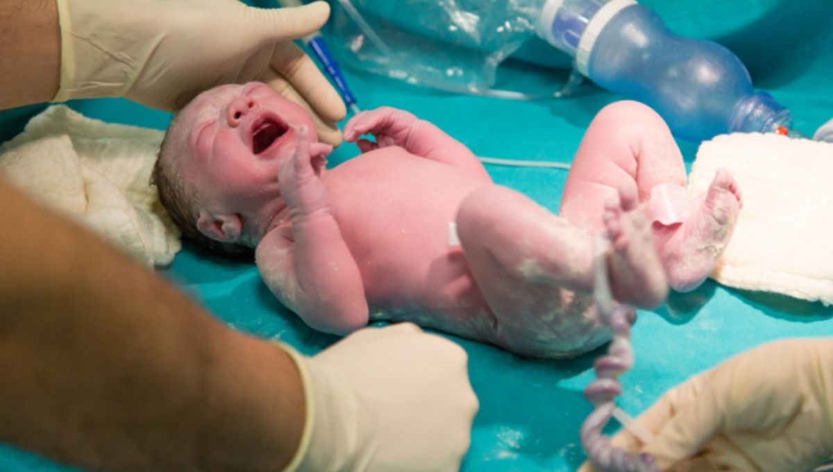 Historical Beliefs About Babies Born with a Cord Around the Neck