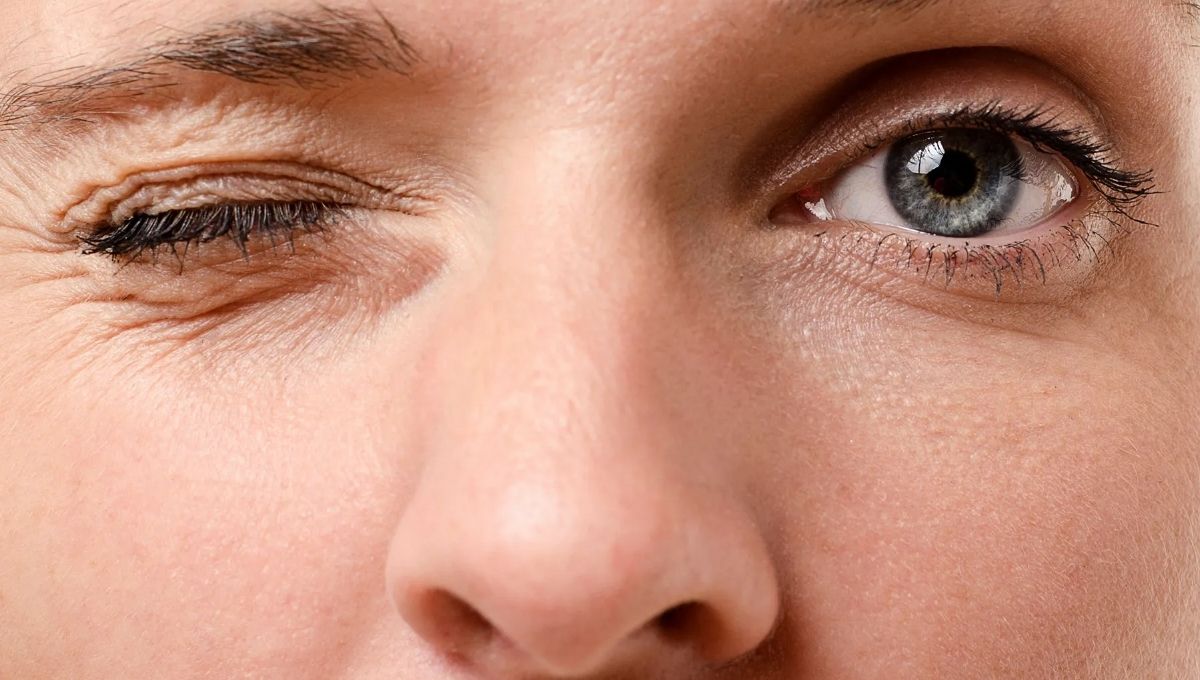 How Eye Twitching is Treated