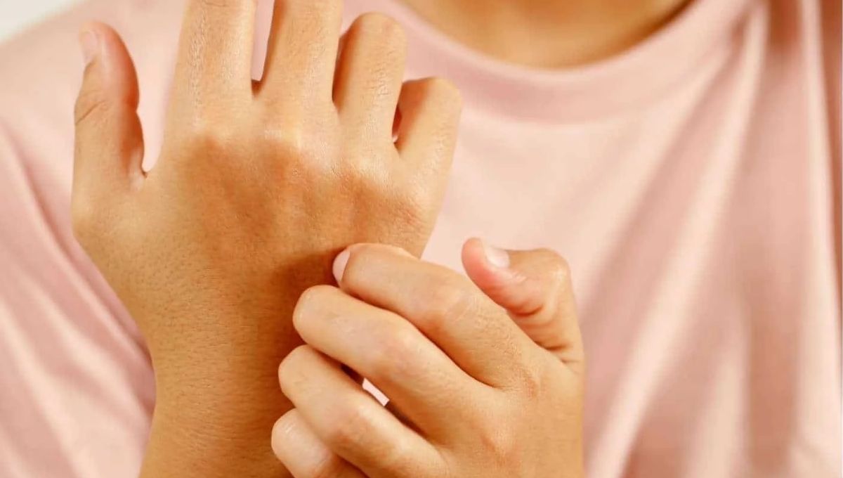 Introduction to Right-Hand Itching