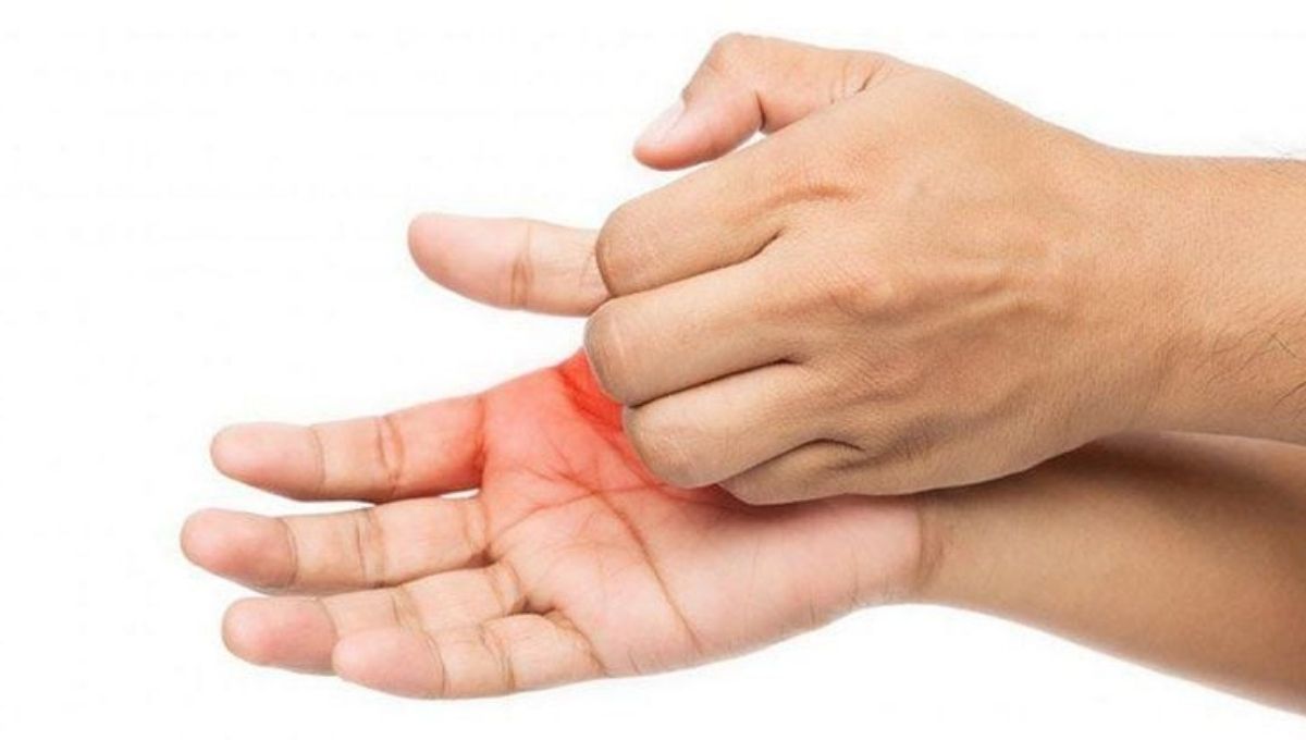 Practical Tips for Responding to Left Palm Itching