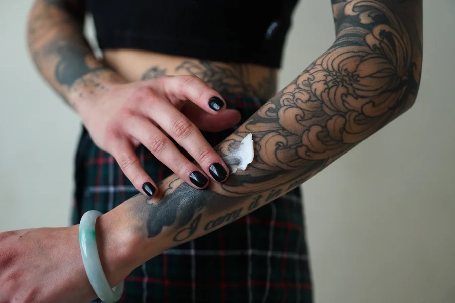 How to Get Rid of Old Tattoos and Start a New Chapter