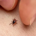 Lyme Disease