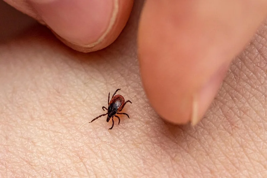 Lyme Disease